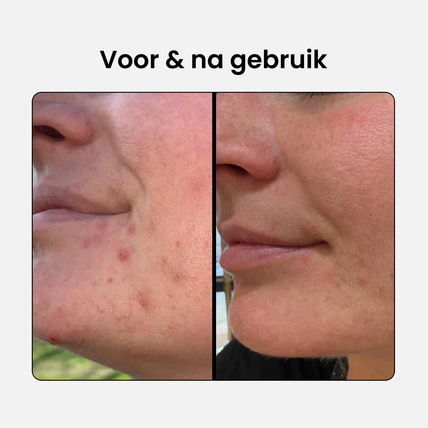 2% BHA Lotion Exfoliant - Image 4