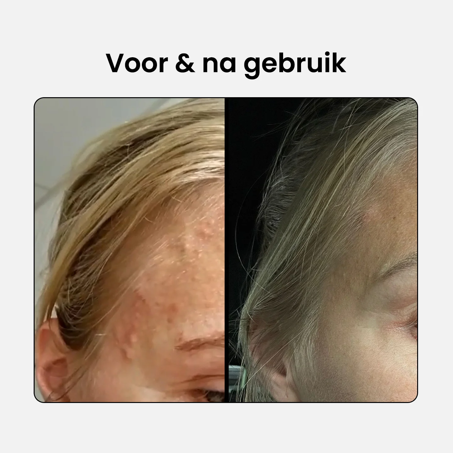 2% BHA Exfoliating Cleanser - Image 4