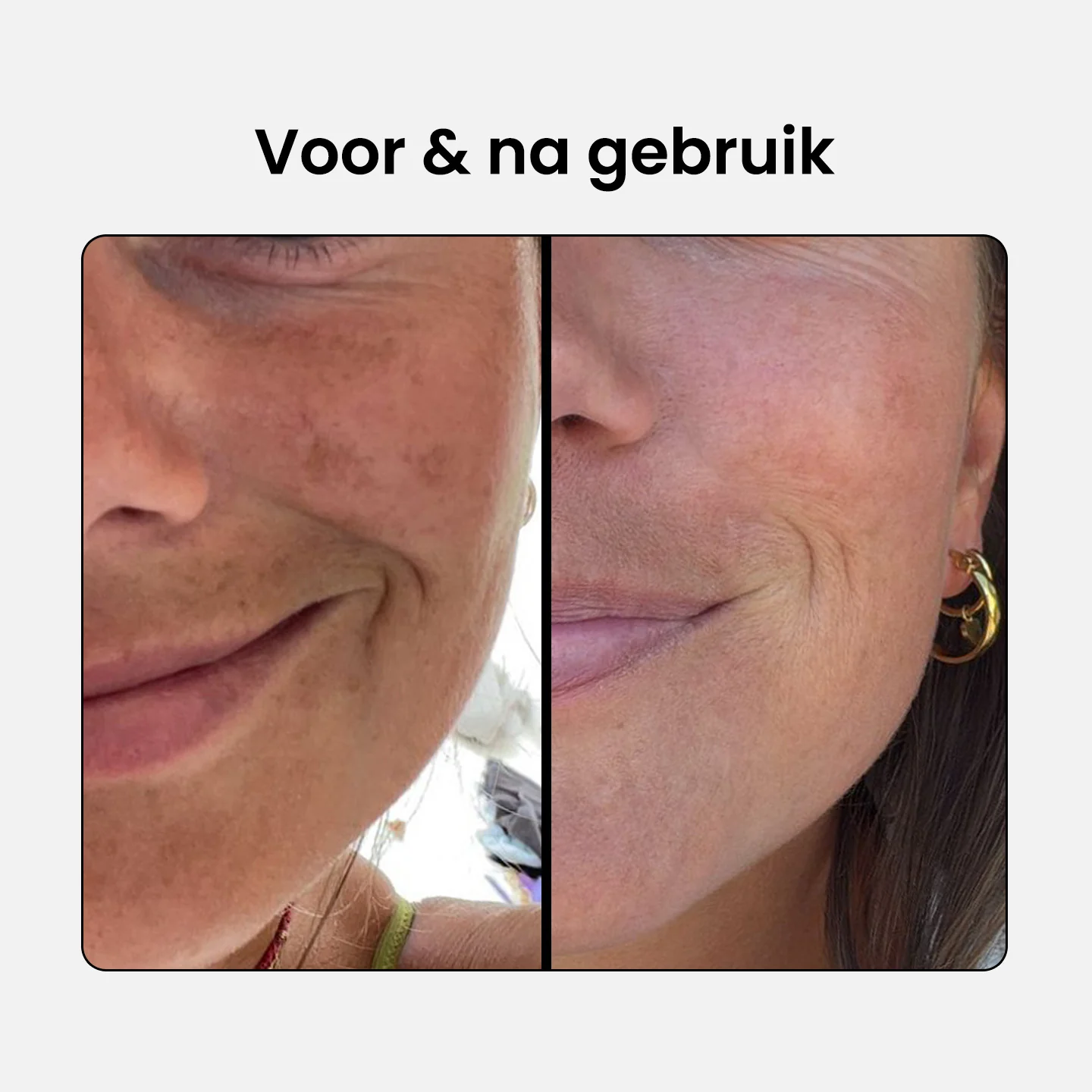 10% Niacinamide Serum - Image 3