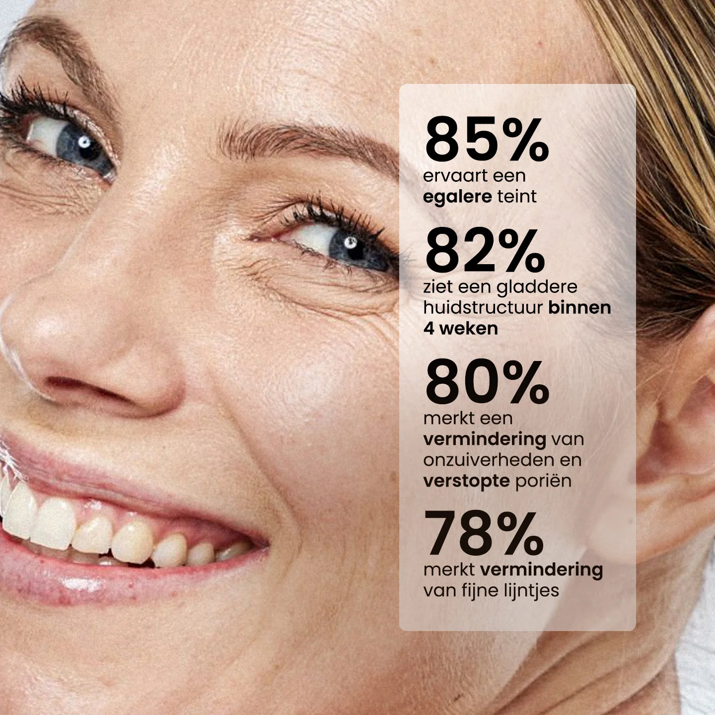 2% Retinol Serum - Image 3